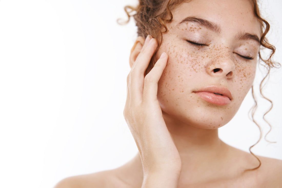 Understanding Hyperpigmentation: What Causes Dark Spots On Your Skin?