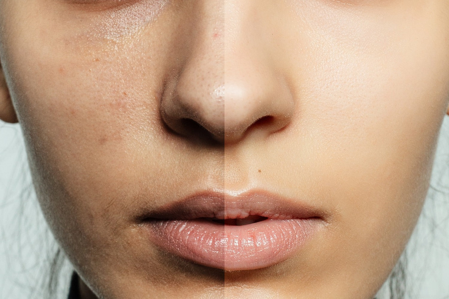 Skincare Routine for Open Pores: How to Minimize and Manage Them